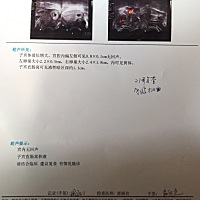 怀孕几周总感觉自己怀了个假孕一样，什么反应都没有能吃能睡有和我一样的吗？