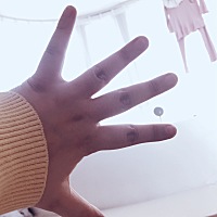 生完宝宝十天了，身上怎么还是肿的厉害呢？怎样才能缓解一下呢？