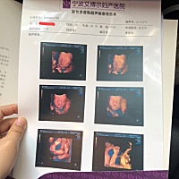 很好奇我的抠脚宝宝是男还是女😄