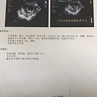 帮忙看看是男孩还是女孩，