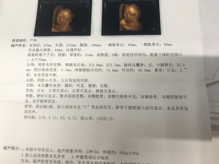 今天早上去做四维啦，十分钟就过了，比想象中顺利好多。有人会看男宝还是女宝嘛，头胎很好奇