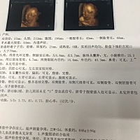 今天早上去做四维啦，十分钟就过了，比想象中顺利好多。有人会看男宝还是女宝嘛，头胎很好奇