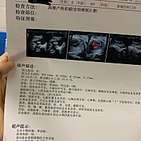 四维结果出来了，有经验的宝妈们帮忙看看是佩奇还是乔治呗