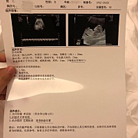 有会看男女的亲吗，说说看，快生了好期待！