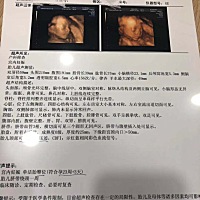 再分享个四维的单子！亲们猜猜男女呗！还有一个月就生了 ！好紧张