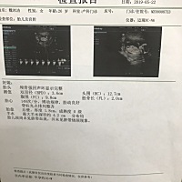 有会看b超单的吗？ 想知道弟弟还是妹妹16周了