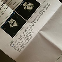 担心害怕。孕酮也从44.67降到20.67