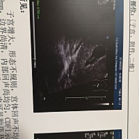 能看得出来是男孩还是女孩呢