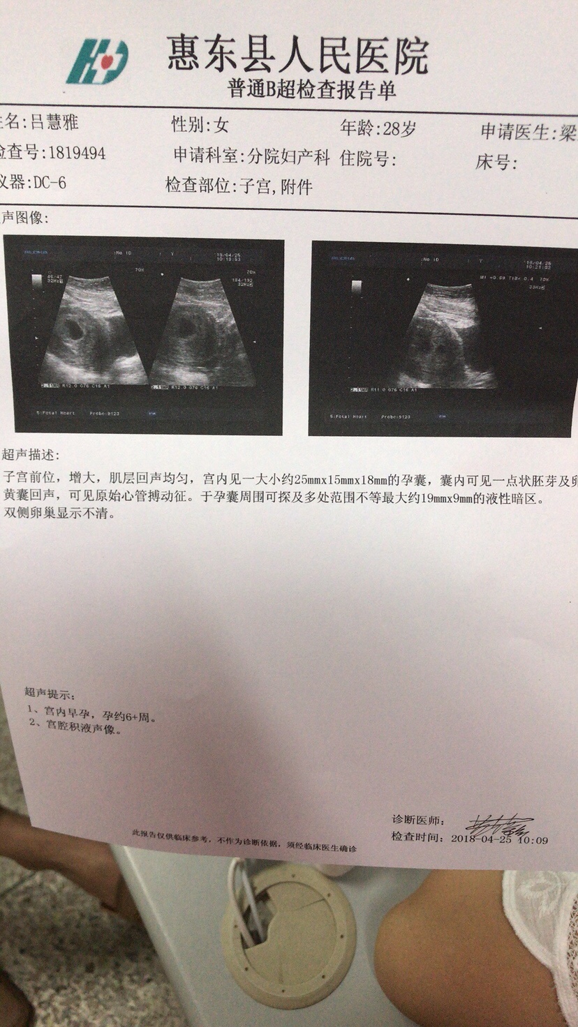 有会看孕囊数据的吗？我想知道这个是男宝宝还是女宝宝