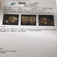 麻烦帮我看看孕囊数据是男孩还是女孩？剖腹产的，希望能如愿