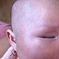 不知道宝宝脸上小疙瘩是什么？各位宝妈知道吗？