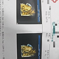 四维一次过，宝贝很给力，开心，医生说胖乎乎的，很可爱哦，目测了一下，额头和高鼻梁像爸爸。😊😊😊