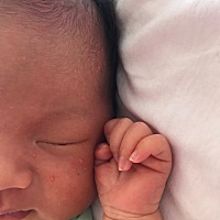 出生20天，脸上一层一层的这种小痘痘顶着白头，头上脸上都是，今天耳朵里也有，有没有遇到