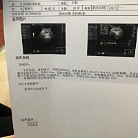 第一次的产检，看你们发的孩子心跳都好快，我俩