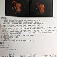 左心室回声斑，三尖瓣反流，这个有事吗？