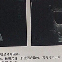 弟媳妇的单子谁能看懂吗，好奇帮忙看下男女