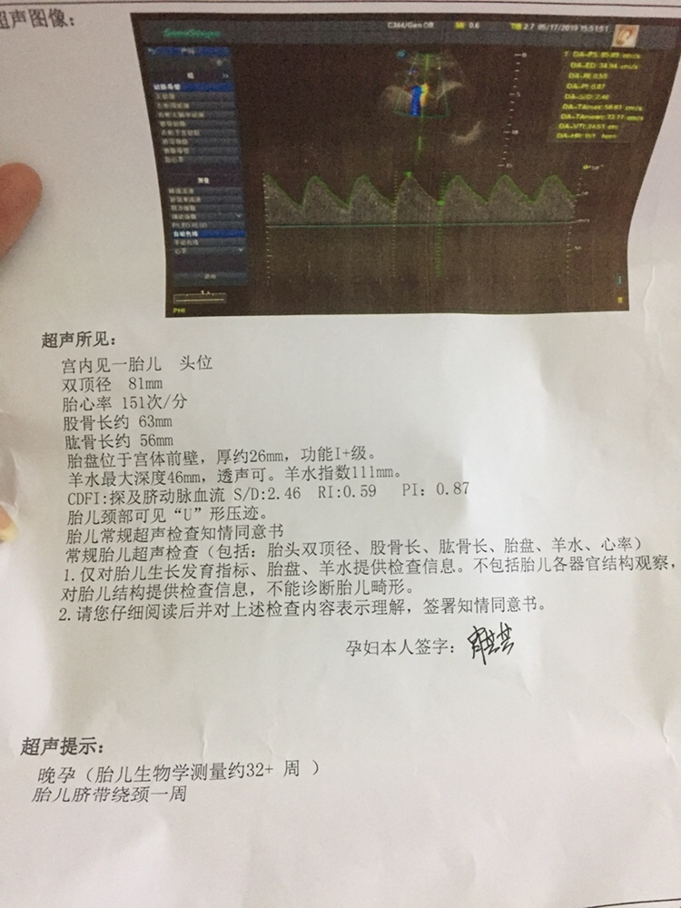 纠结是男是女？？？