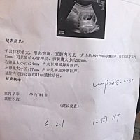 一切正常，等12周做NT😁