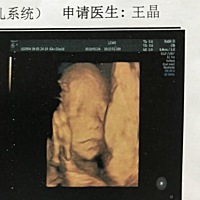 四维顺利通过，大家看看像男宝女宝