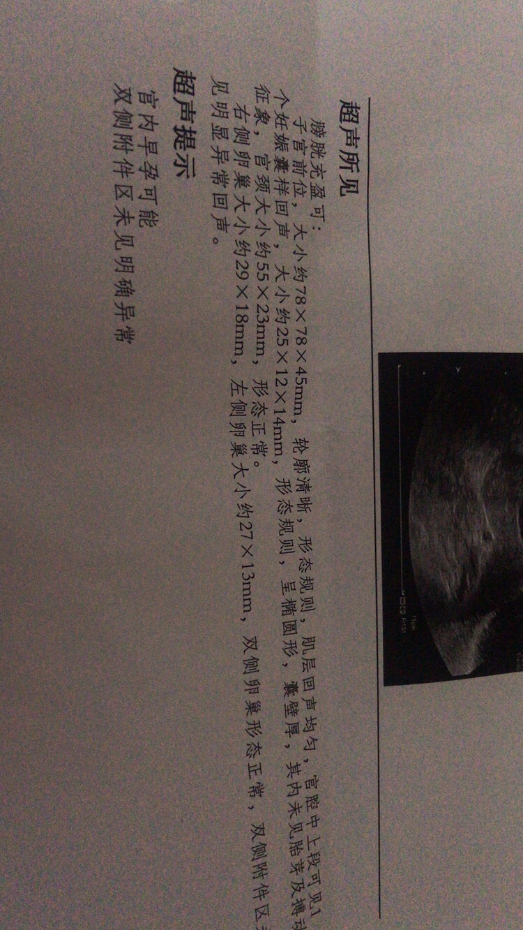 第一张是4月29日照的，医生说当时35天，第二张是60天照的，没有胎心胎芽，医生说胚胎已经停止发育了，单子显示胚胎才40天大，