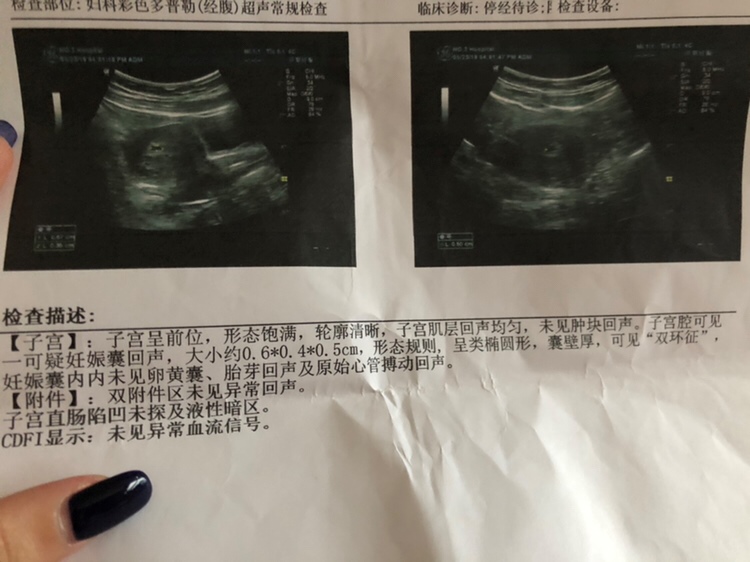 请问这是怀孕了吗？