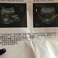 请问这是怀孕了吗？ 请问这是怀孕了吗？