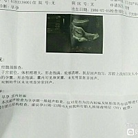 孕囊三个数据，看男女准不准啊？各位有知道的吗？