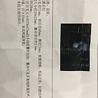 你们有怀孕发现自己肚子里原来有个畸胎瘤的吗？