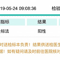 测出怀孕后，医生说62天去医院检查胎心胎芽，排除宫外孕，百度又说直接等12周（84天）做第一次产检，姐...
