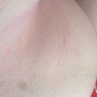 亲们，怀孕六个多月，现在天气热了，我一天洗两次澡，为什么胸下边一片片的红，而且特别痒，仔细看有的...