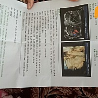 昨天我去做B超了。我去做了四维，四维通过了我又抽了血。然后我又肚子疼，开了点药。吃了点药就不疼，然...