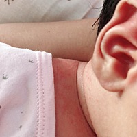 各位宝妈，帮我看看，我家宝宝长的是什么东西？好紧张😰😰😰😰