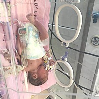 5.21男宝宝后期左右鼓大包 5