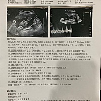 27周，谁会看男包女宝