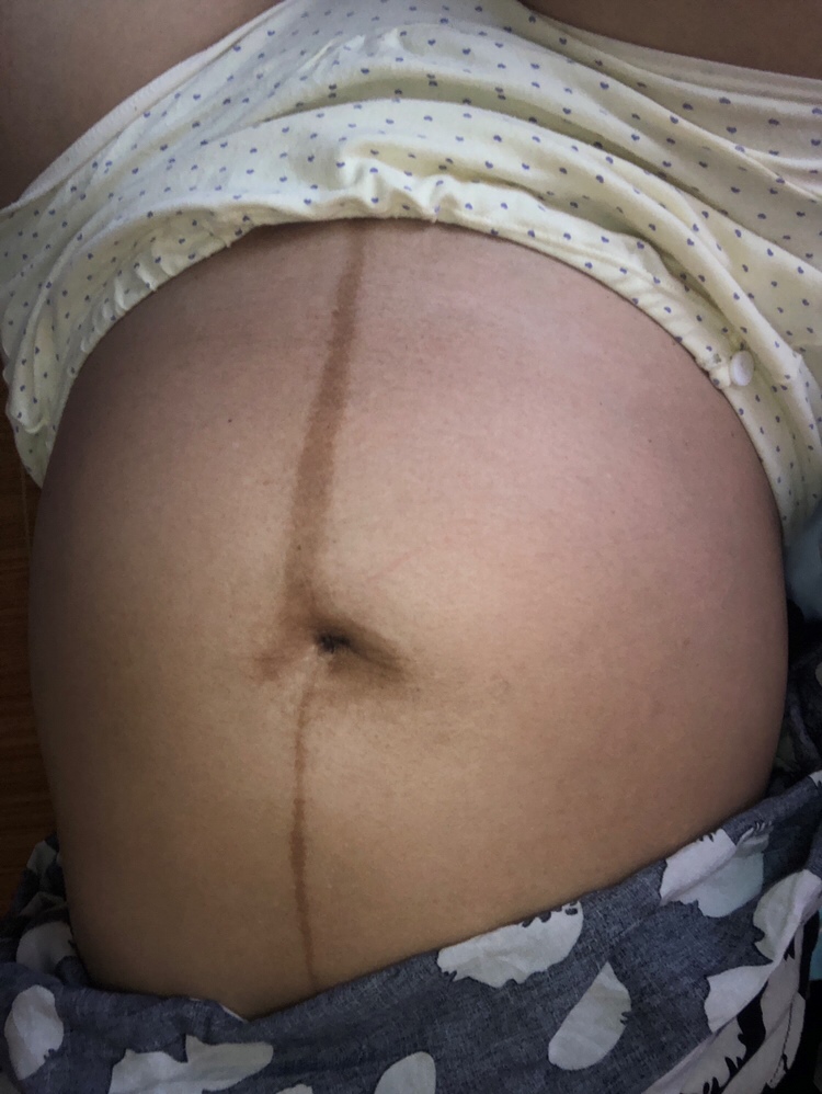 我怀孕五个月多了，谁能帮我看看是男孩女孩？