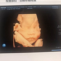 看到四维照片时发誓妈妈会好好爱你现在时不时拿这张看。