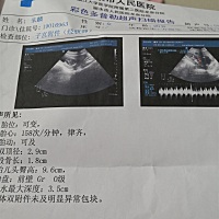 怀孕15周的B超单，请问这是男孩还是女孩？