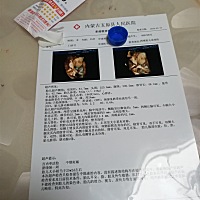 四维彩超检查: 不知道是不是女宝？女宝赶紧发动你的超能力吧！😍😍😍