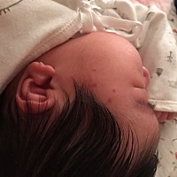 今天突然发现妹妹脸上有4个小红斑 是要发湿疹了么 求解