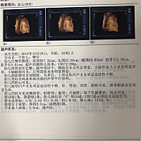 今天又一次产检了，之前都说我肚子小，宝宝彩超显示也偏小了几天，但都在正常范围内，羊水值也正常，所...