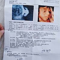 26周＋5天，宝妈们帮我看看，女宝还是男宝😄