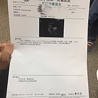 有经验的姐妹帮忙预测一下是男孩女孩呢？