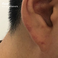 这是吻痕吗