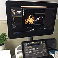 本院做了四维，看到了宝宝，不像我，我不像他爸爸，这宝宝长得很有自己的想法，哈哈哈！