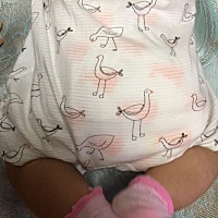 各位宝妈，十分紧急，有没有在哺乳期长寻麻疹的。我要疯了，怎么办，我要怎么办。