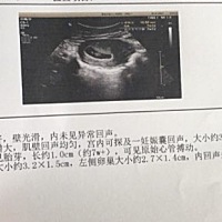 大家都来猜猜是男还是女孩？压力山大