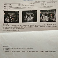 看看这个是男孩还是女孩，谢谢大家了
