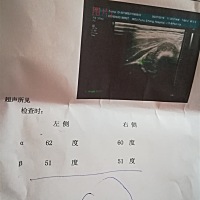 宝宝42天检查，做的髋关节彩超，这个数值，正常吗？