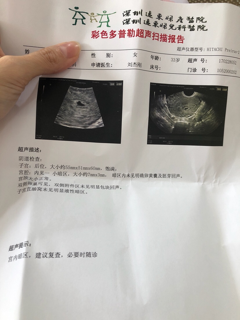 月经推迟10天，一来医生，啥都知道，就先给你lai g