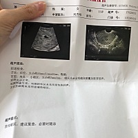 月经推迟10天，一来医生，啥都知道，就先给你lai g